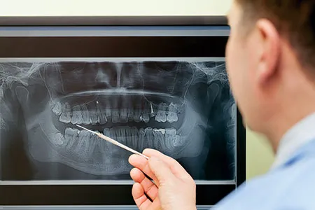 dental x-ray